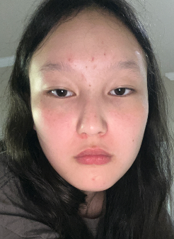 Erkai A., 19 After