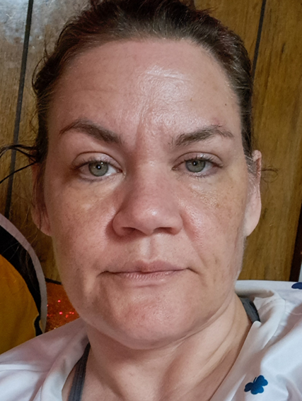 Amy F., 46 After