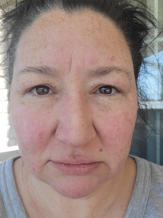 Beth S., 36-50 After