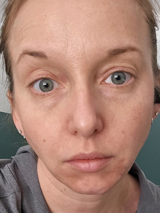 Brittany W., 38 After