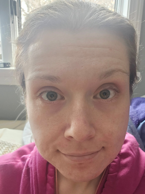 Cassie Z., 32 After