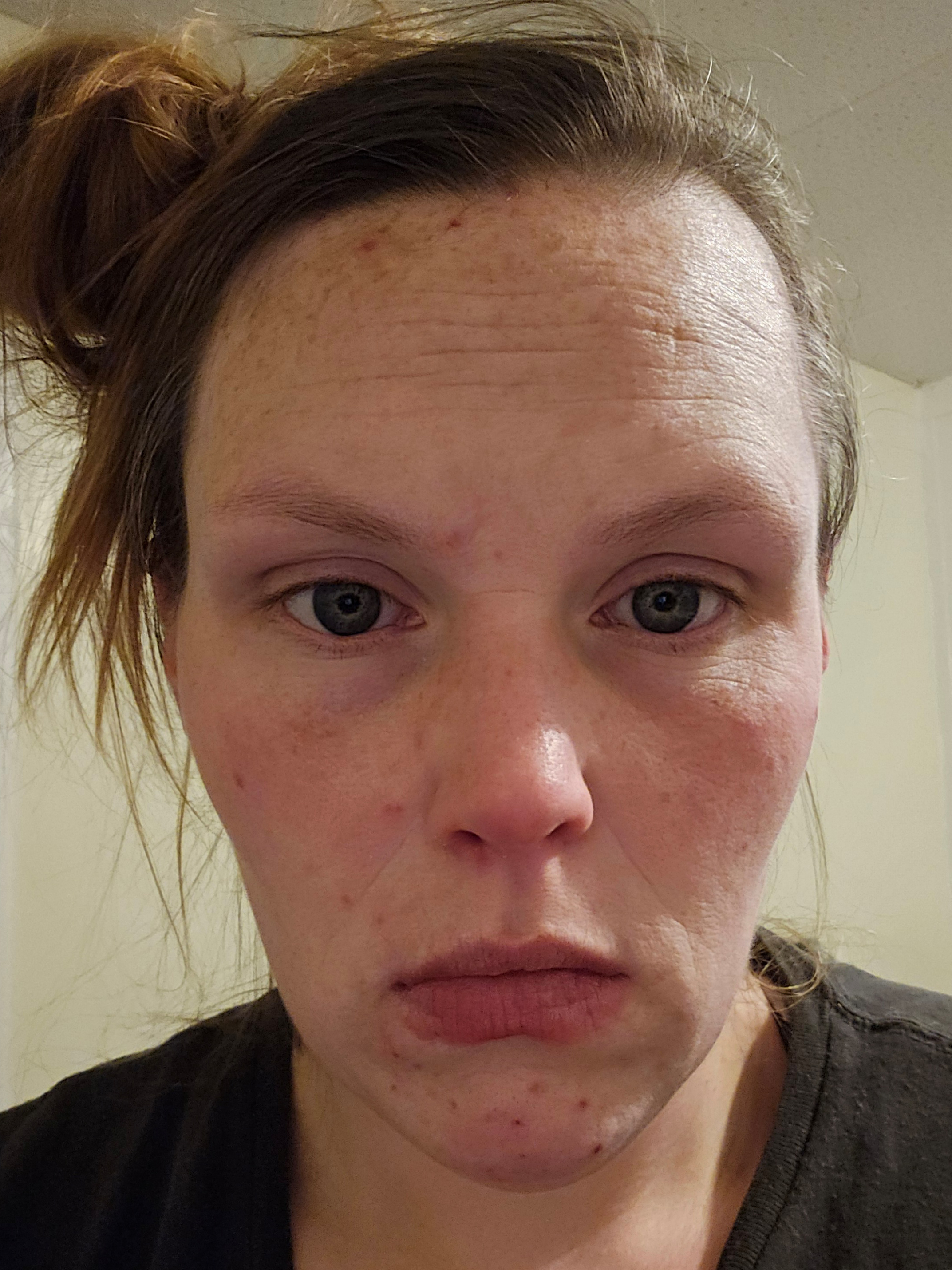 Alyssa C., 34 After