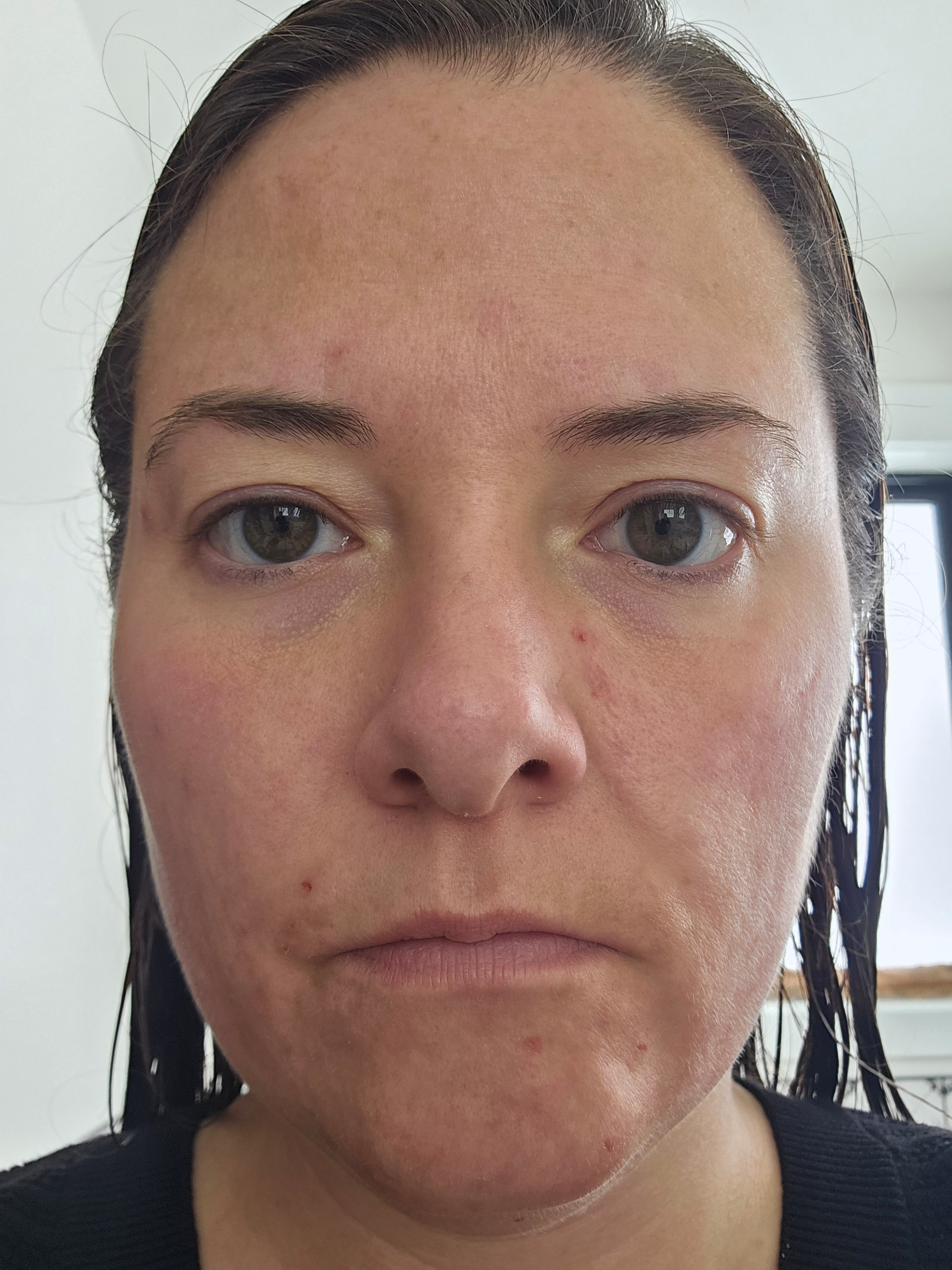 Ashley R., 35 After