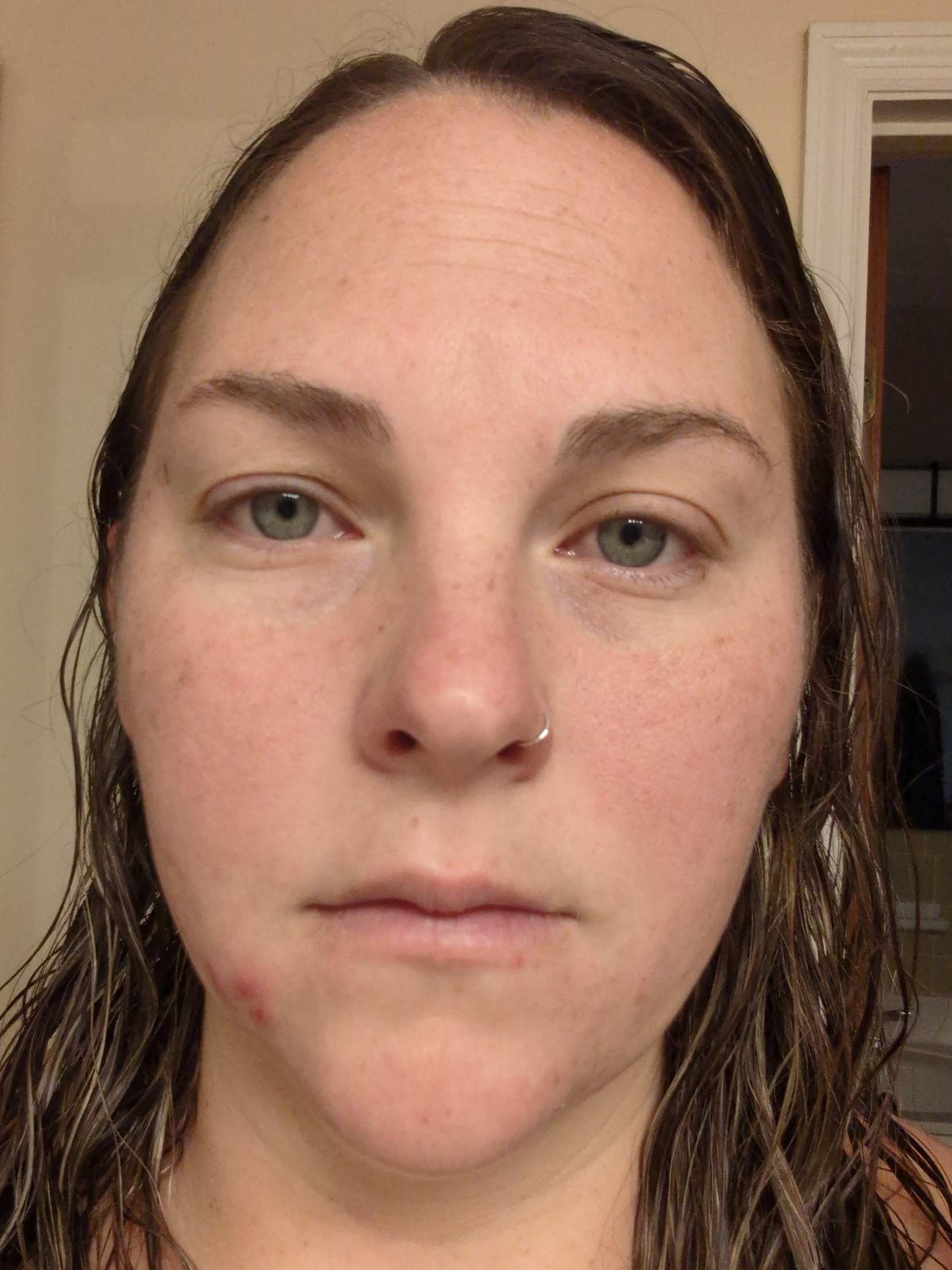 Caitlyn B., 31 After