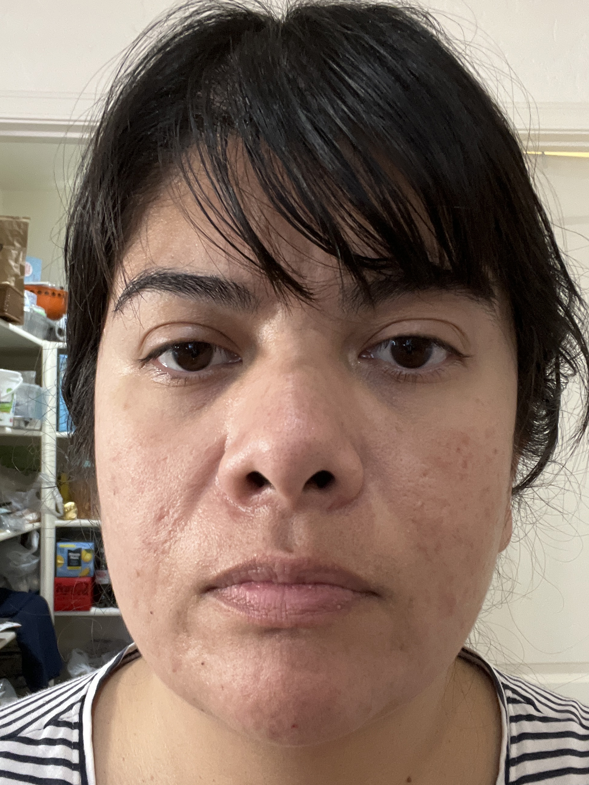 Francisca M., 38 After