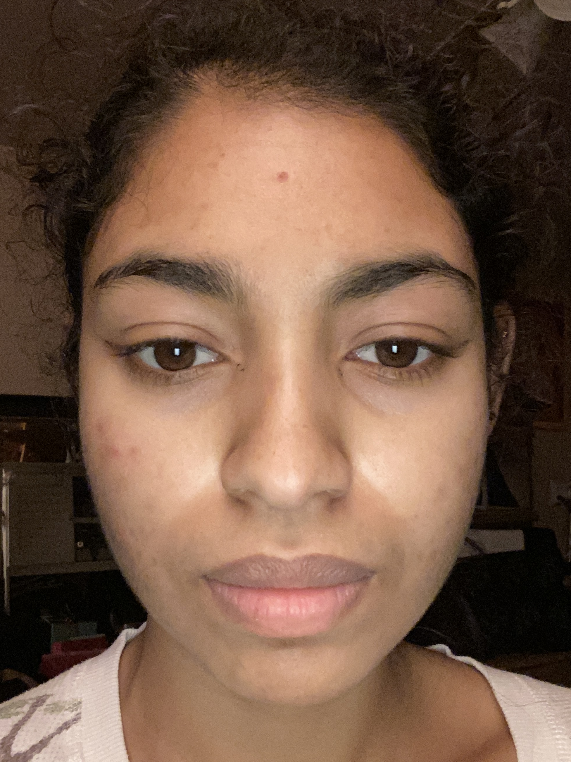 Karen Michelle C., 25 After