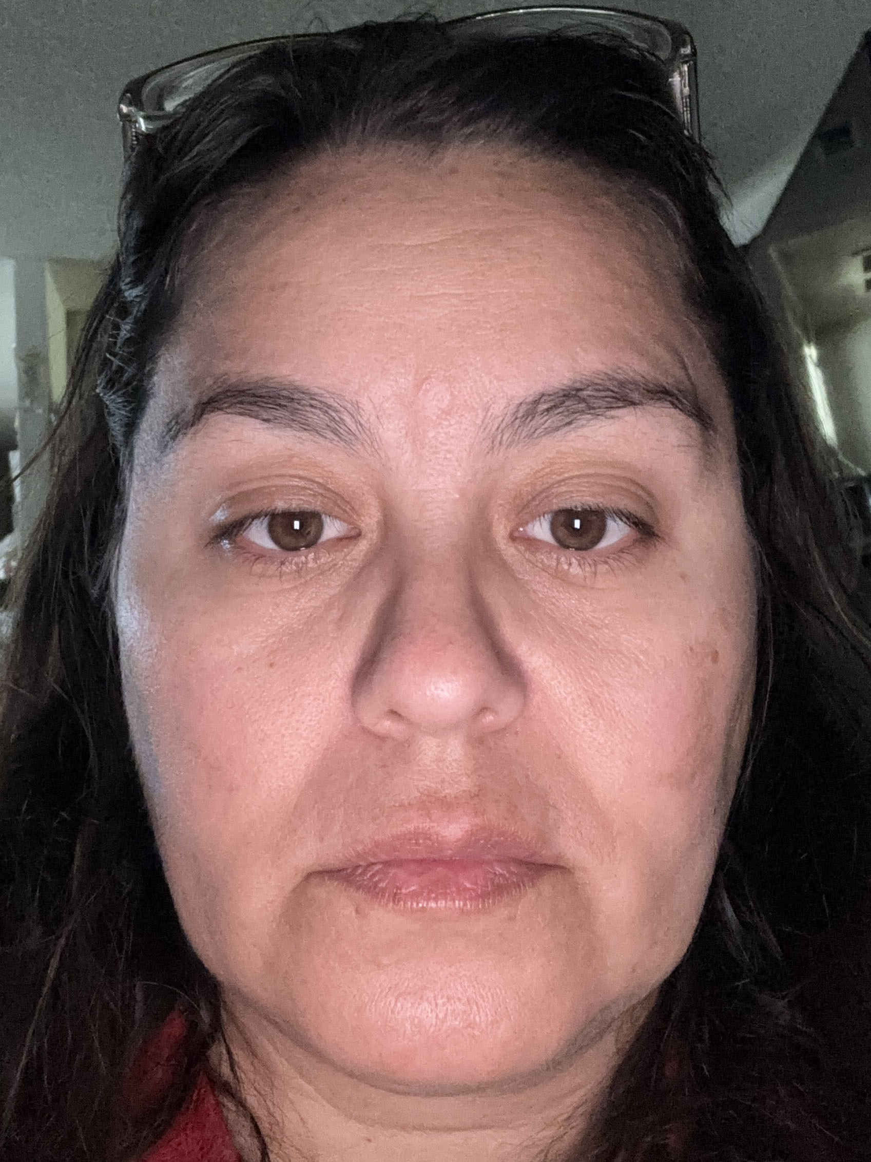 Barbara R., 44 After