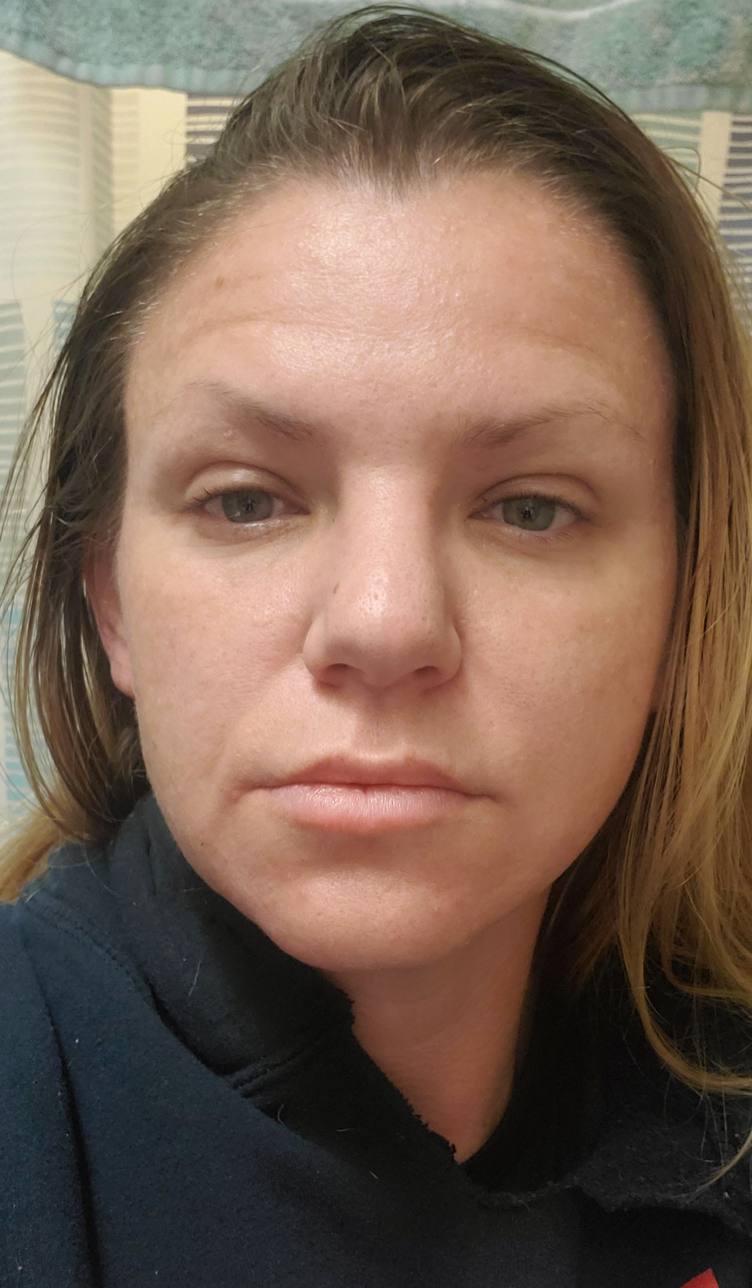 Cassey H., 40 After