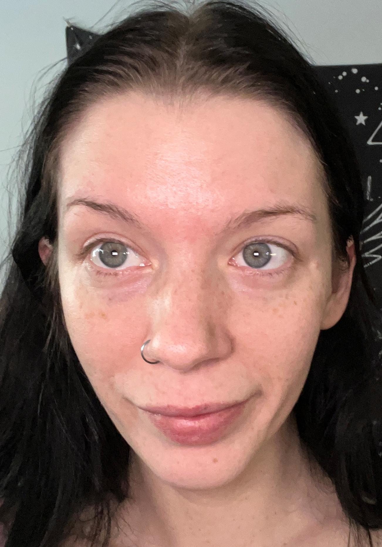 Chelsey D., 27 After