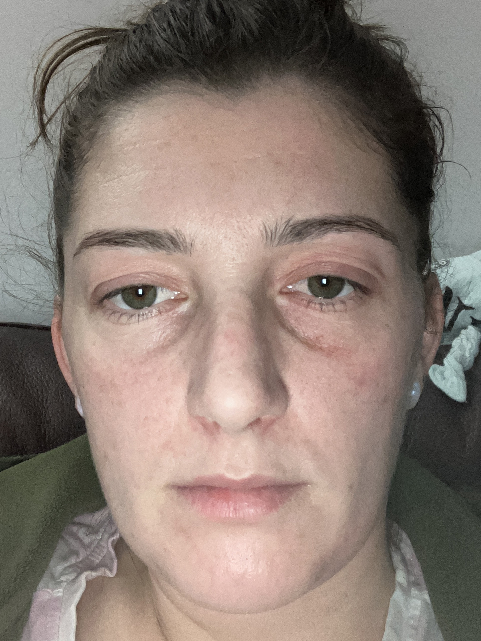 Stacey B., 31 After