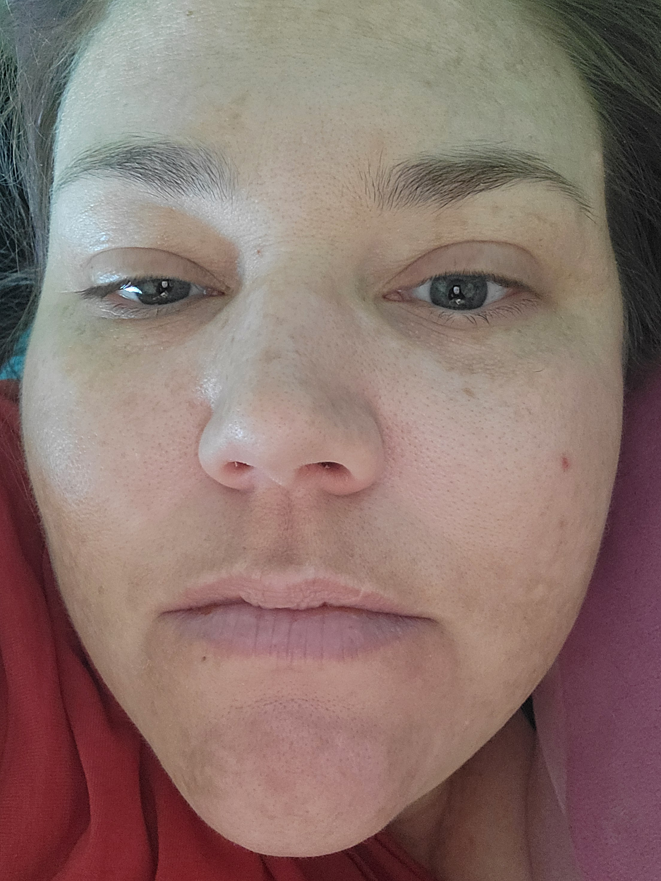 Courtney P., 35 After