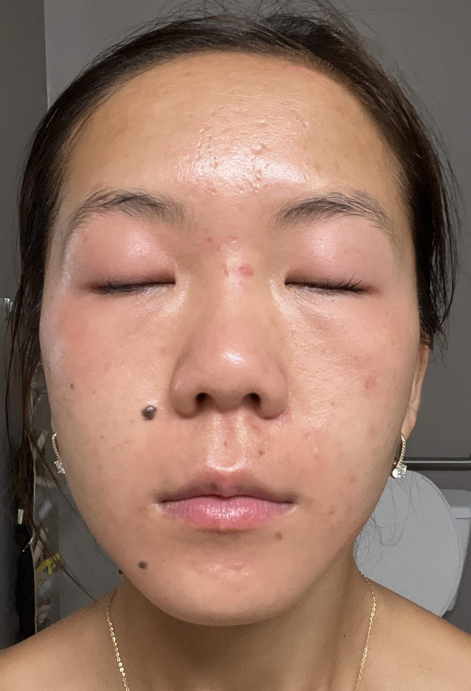 Jade M., 27 After