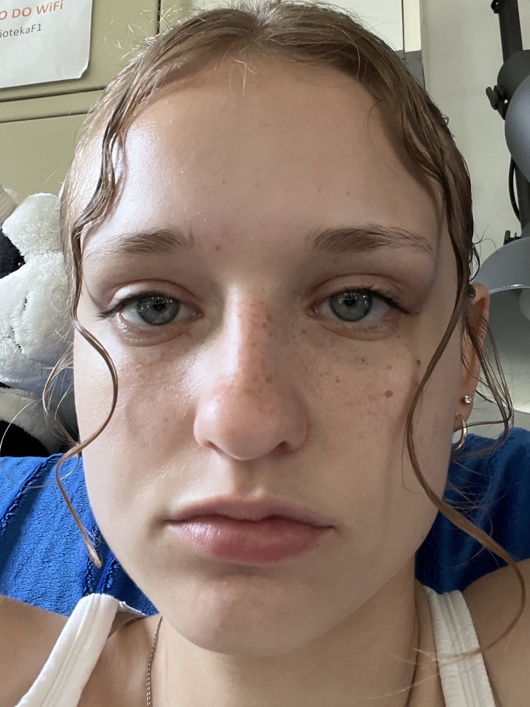 Magdalena P., 20 After