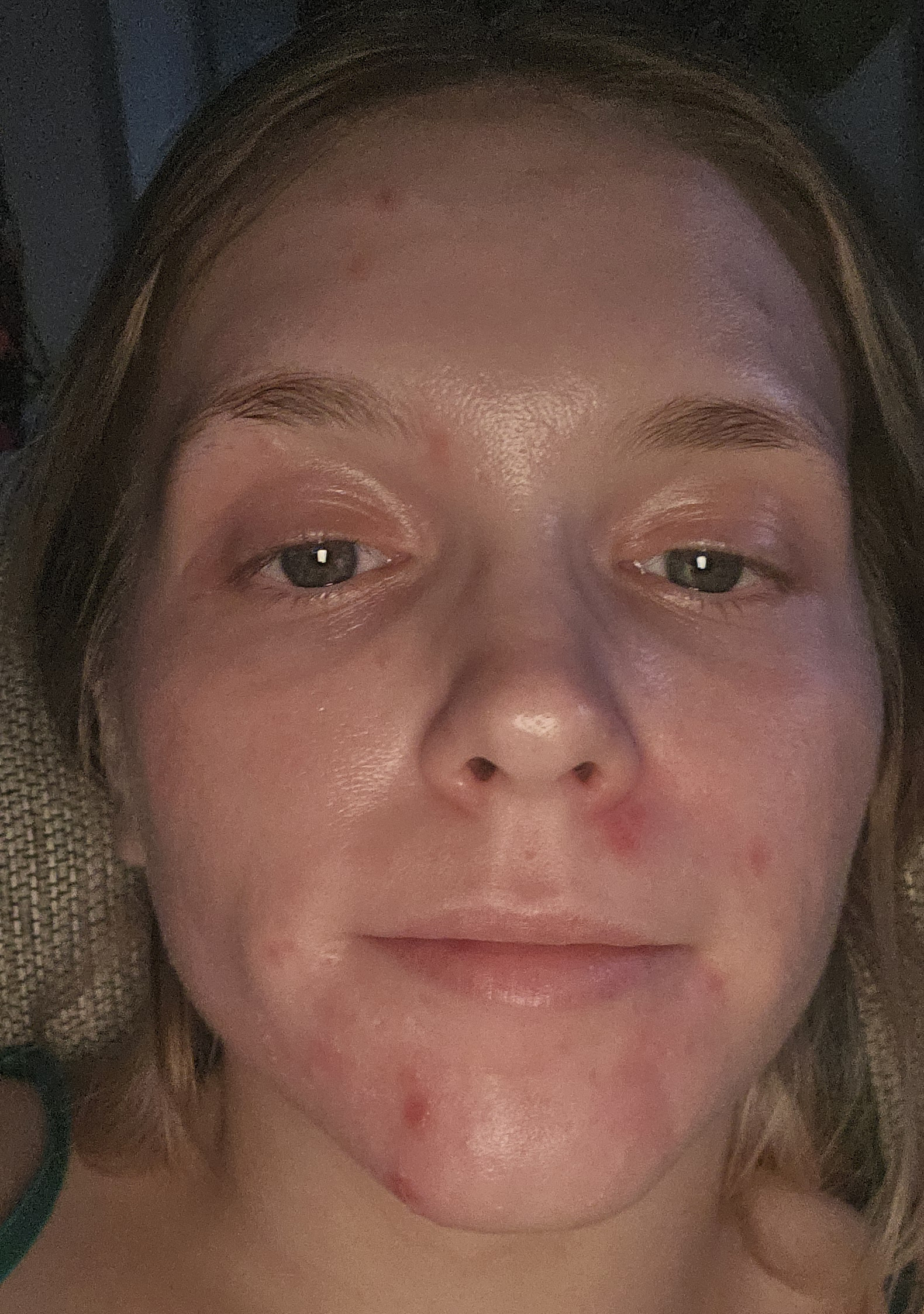 Samantha W., 28 After