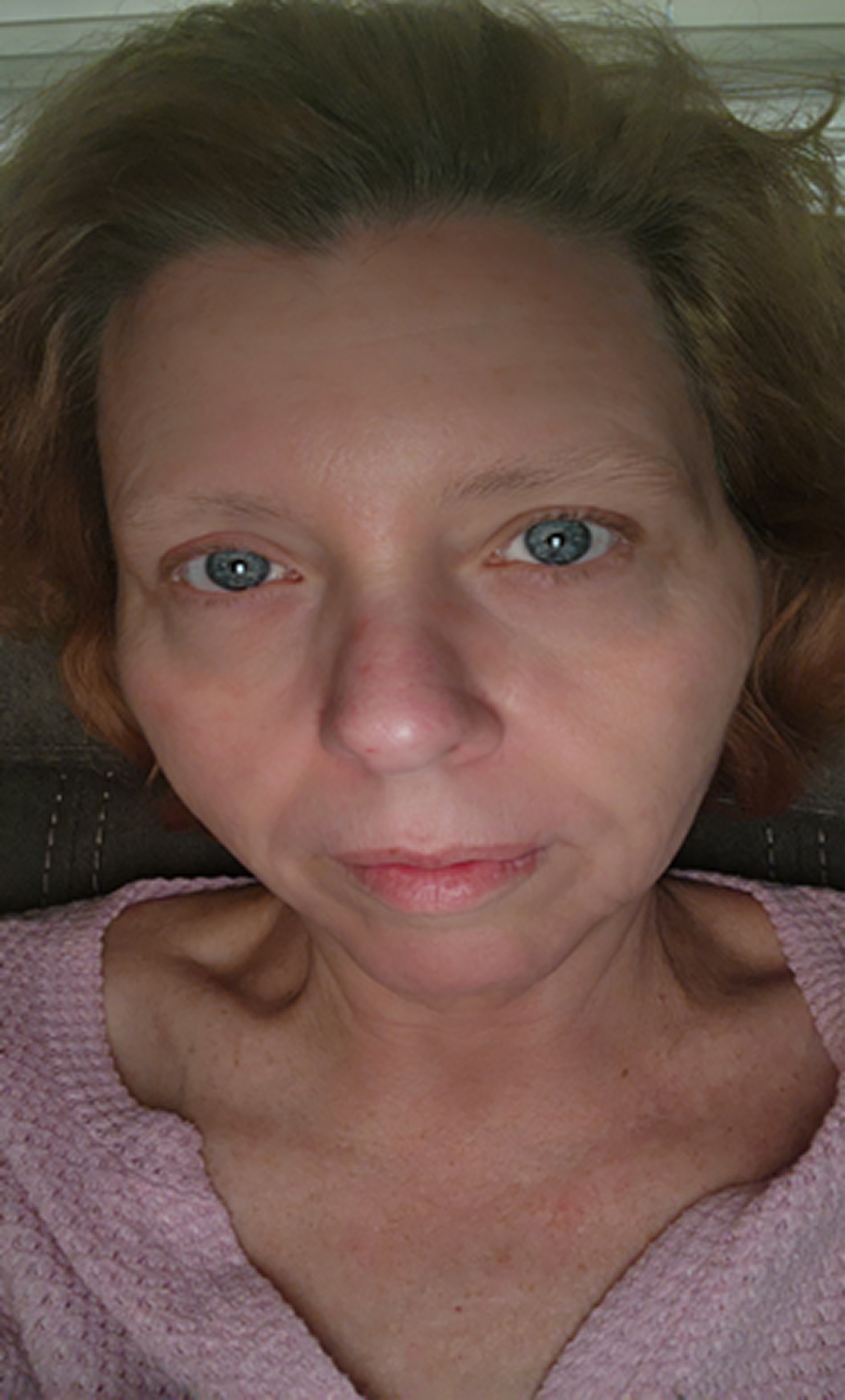 Jenny W., 56 After