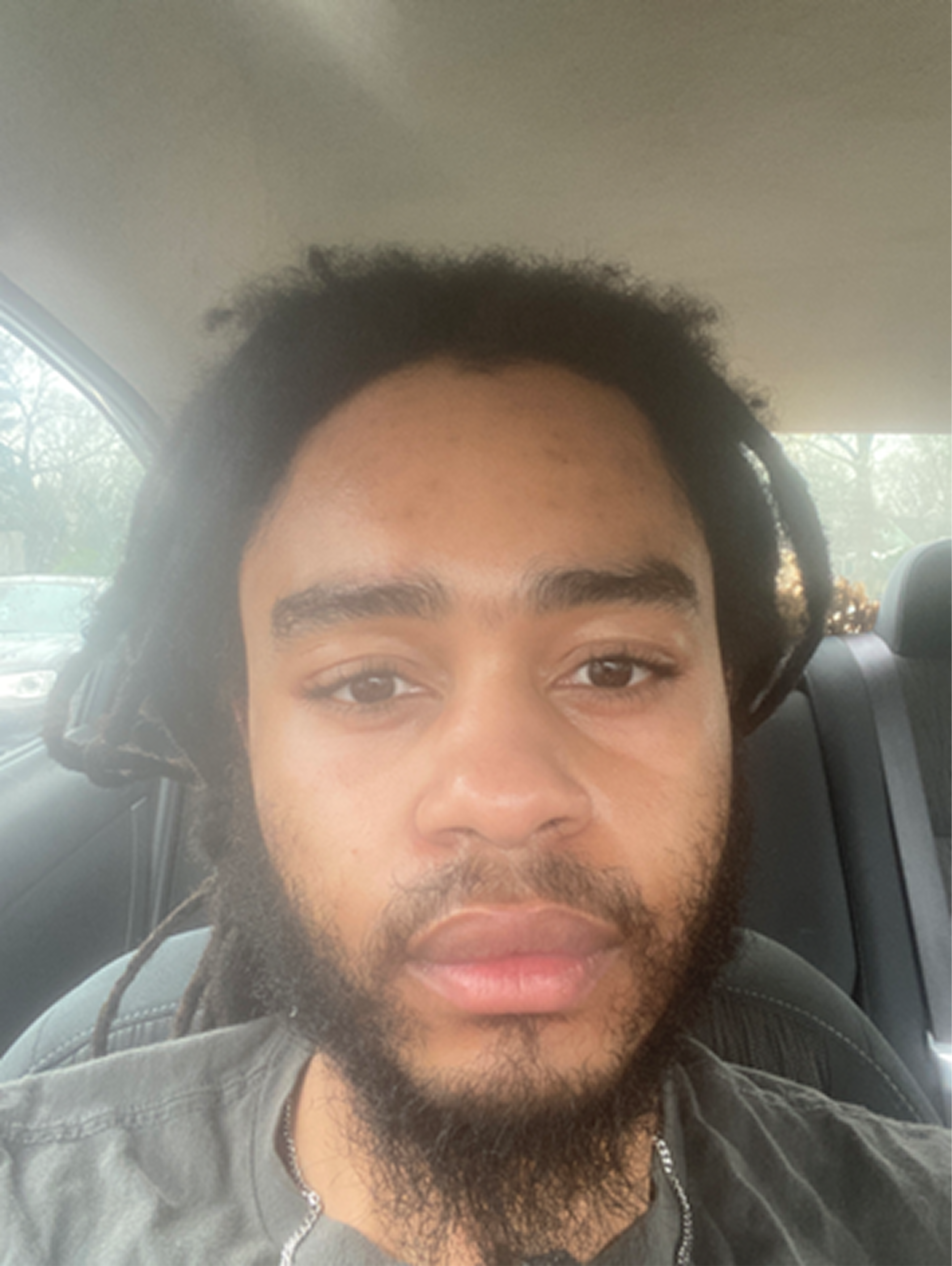 Brandon L., 22 After