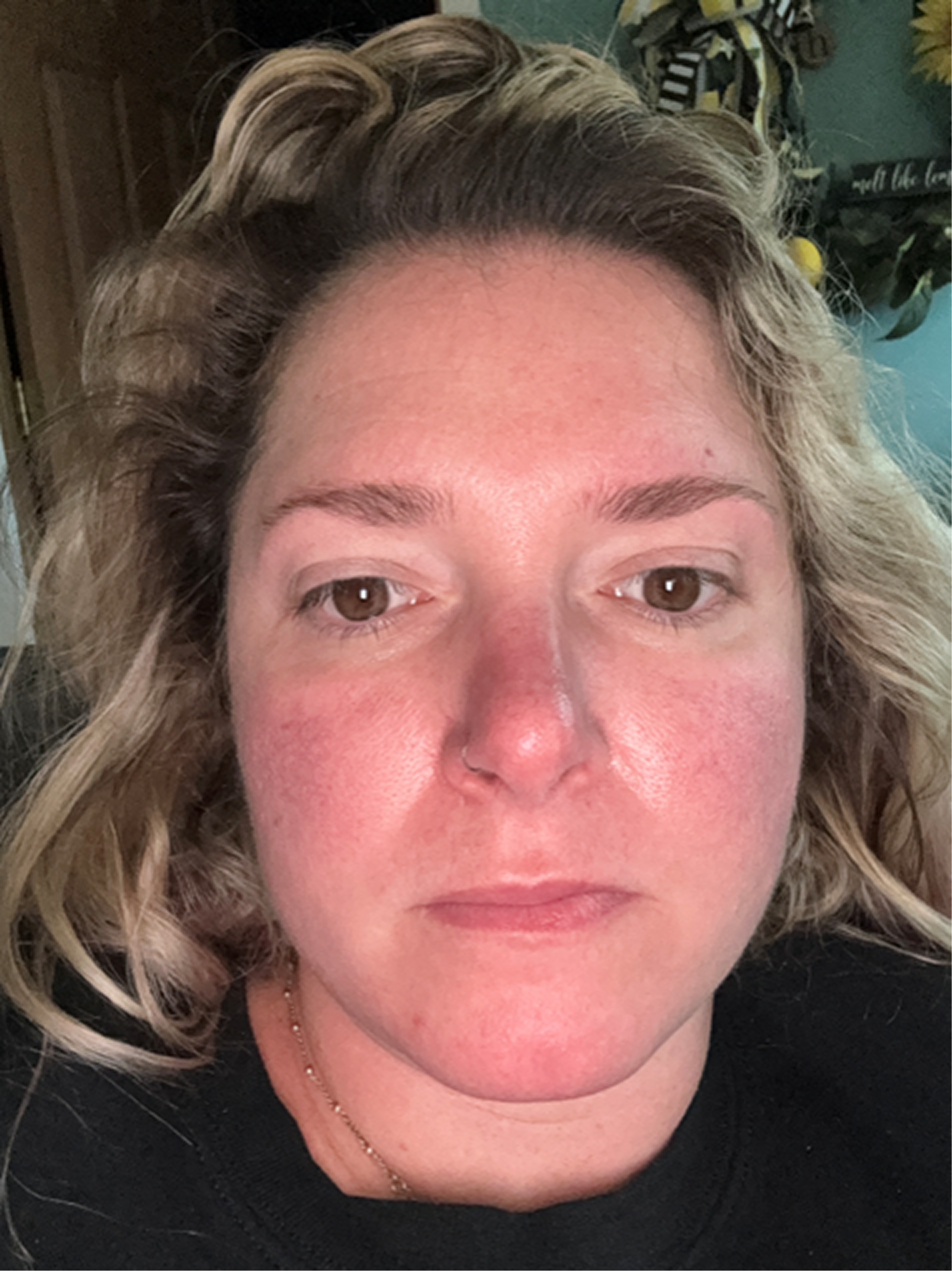 Kayla S., 33 After