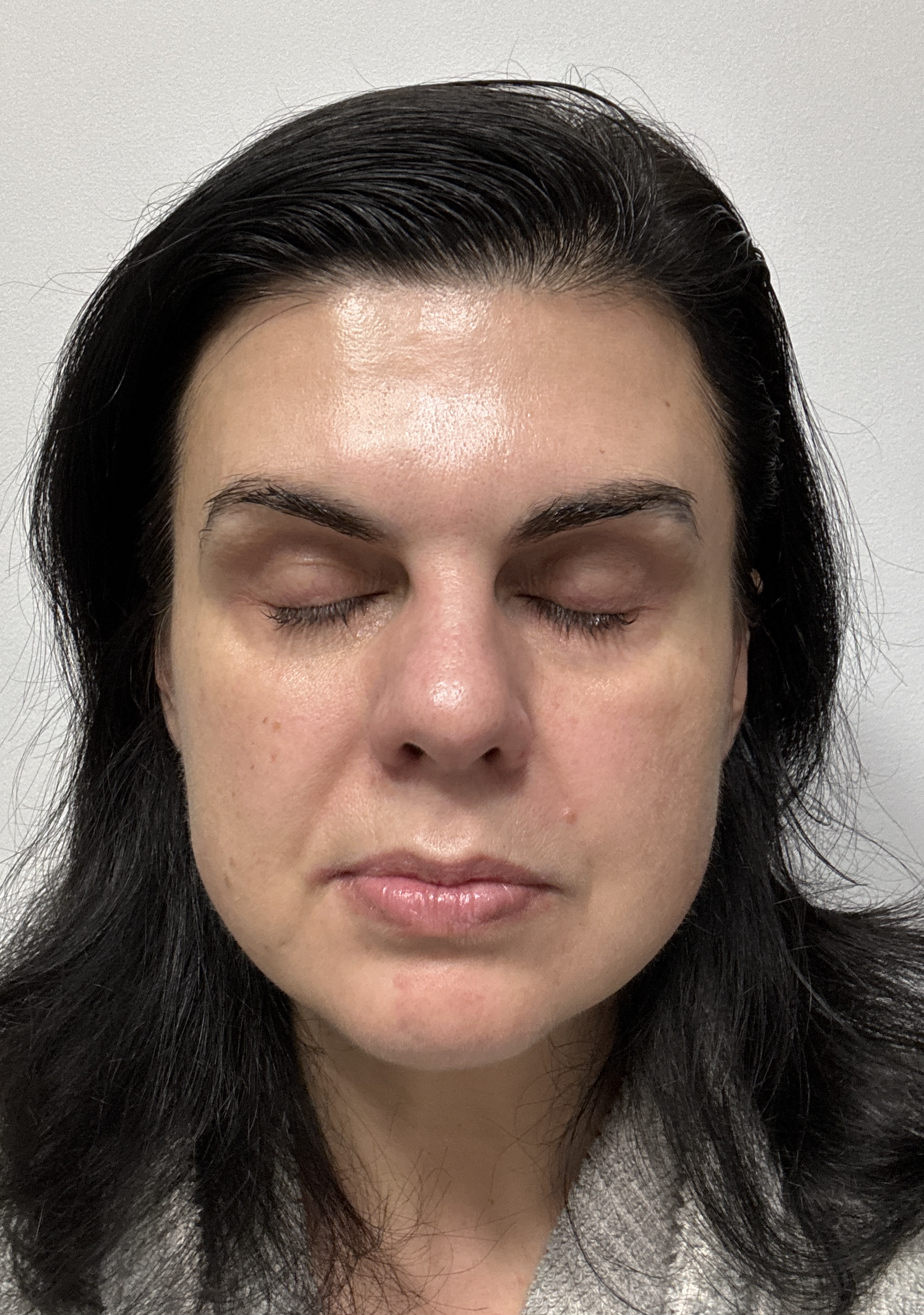 Halyna M., 46 After