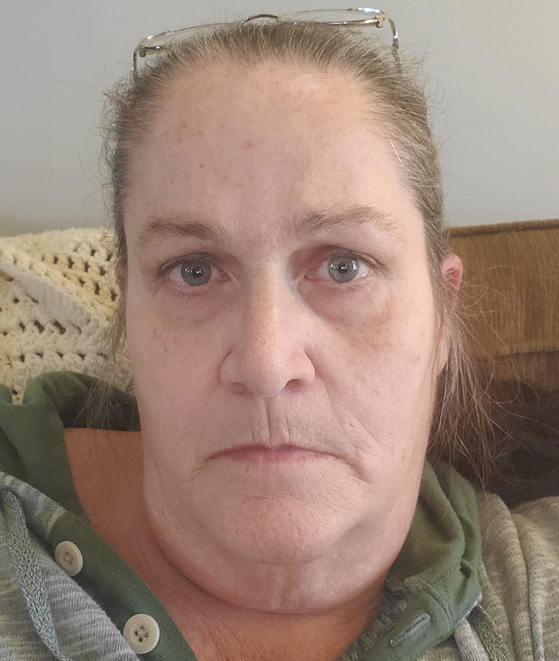 Barbara W., 58 After