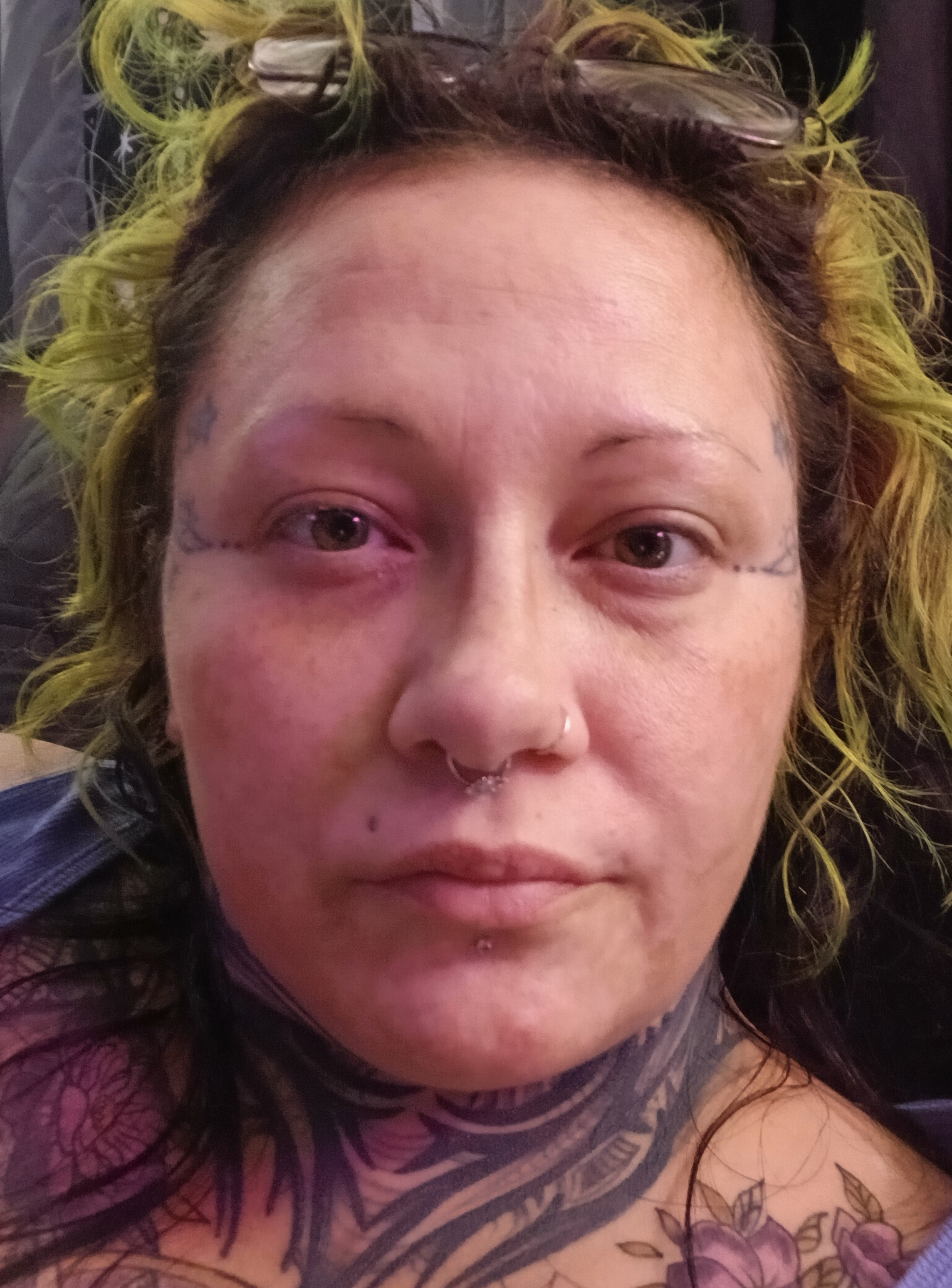 Ashleigh K., 39 After