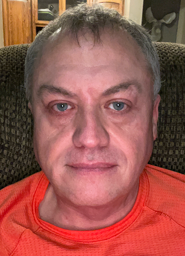 Michael A., 51 After