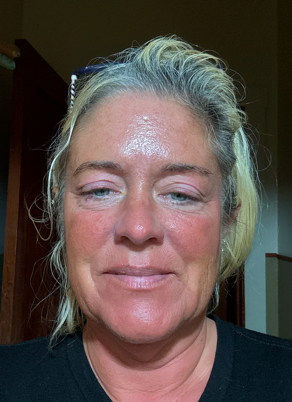 Christina C., 52 After