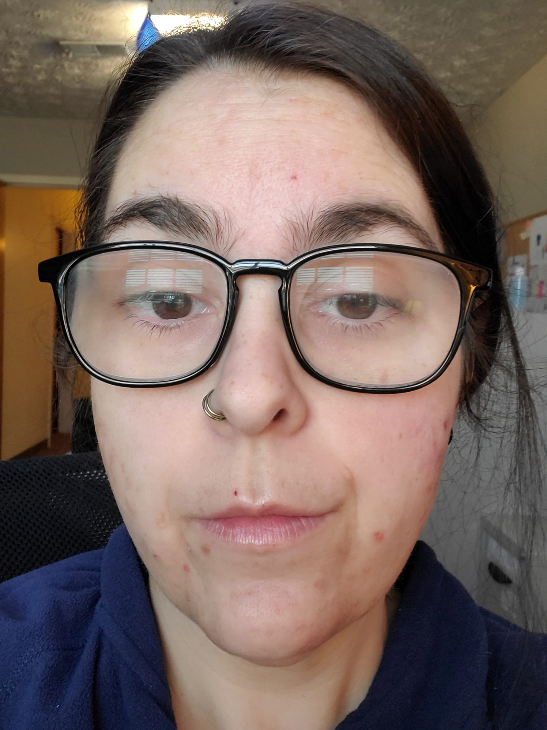 Amanda A., 37 After
