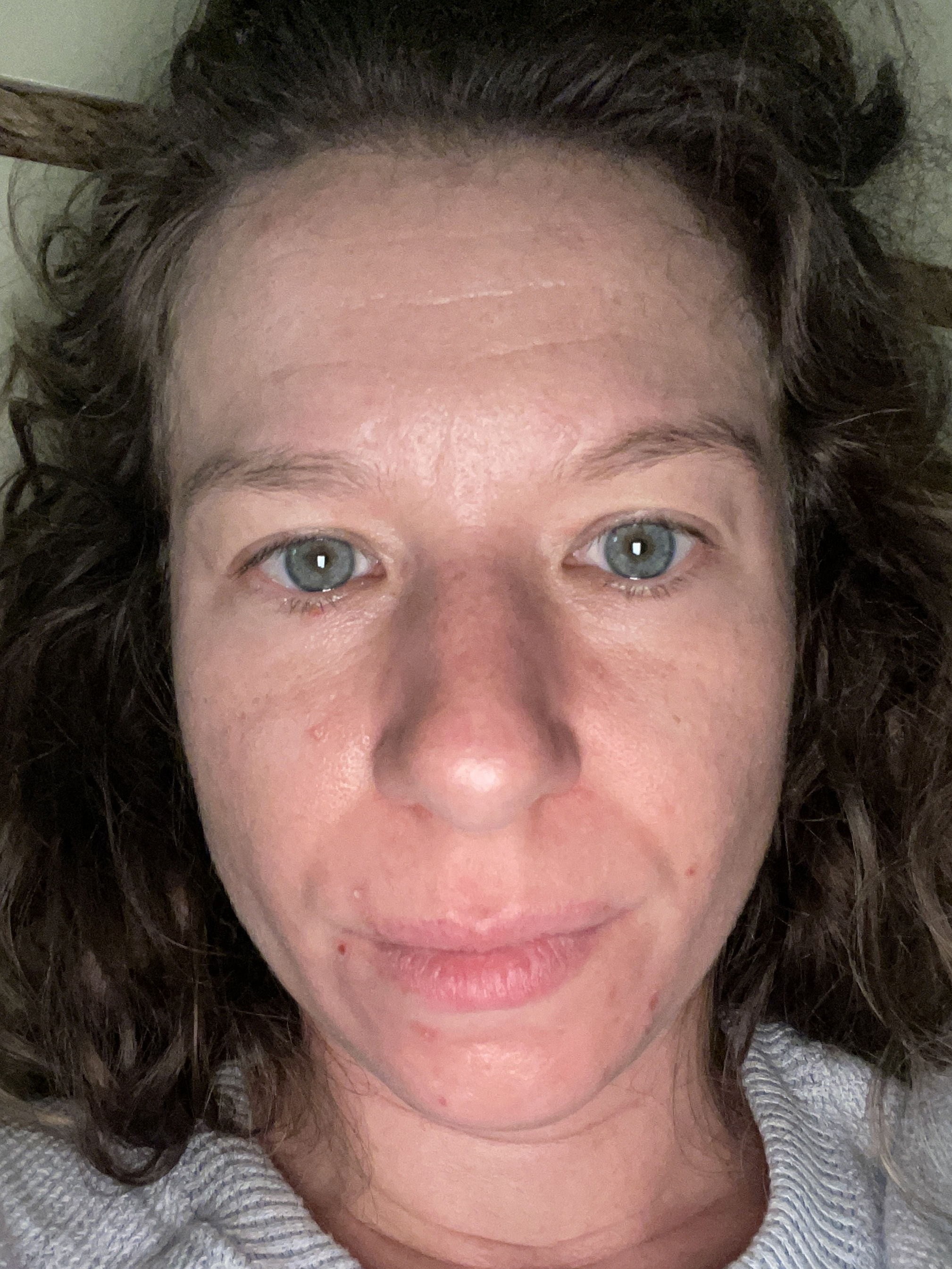 Kristen B., 37 After