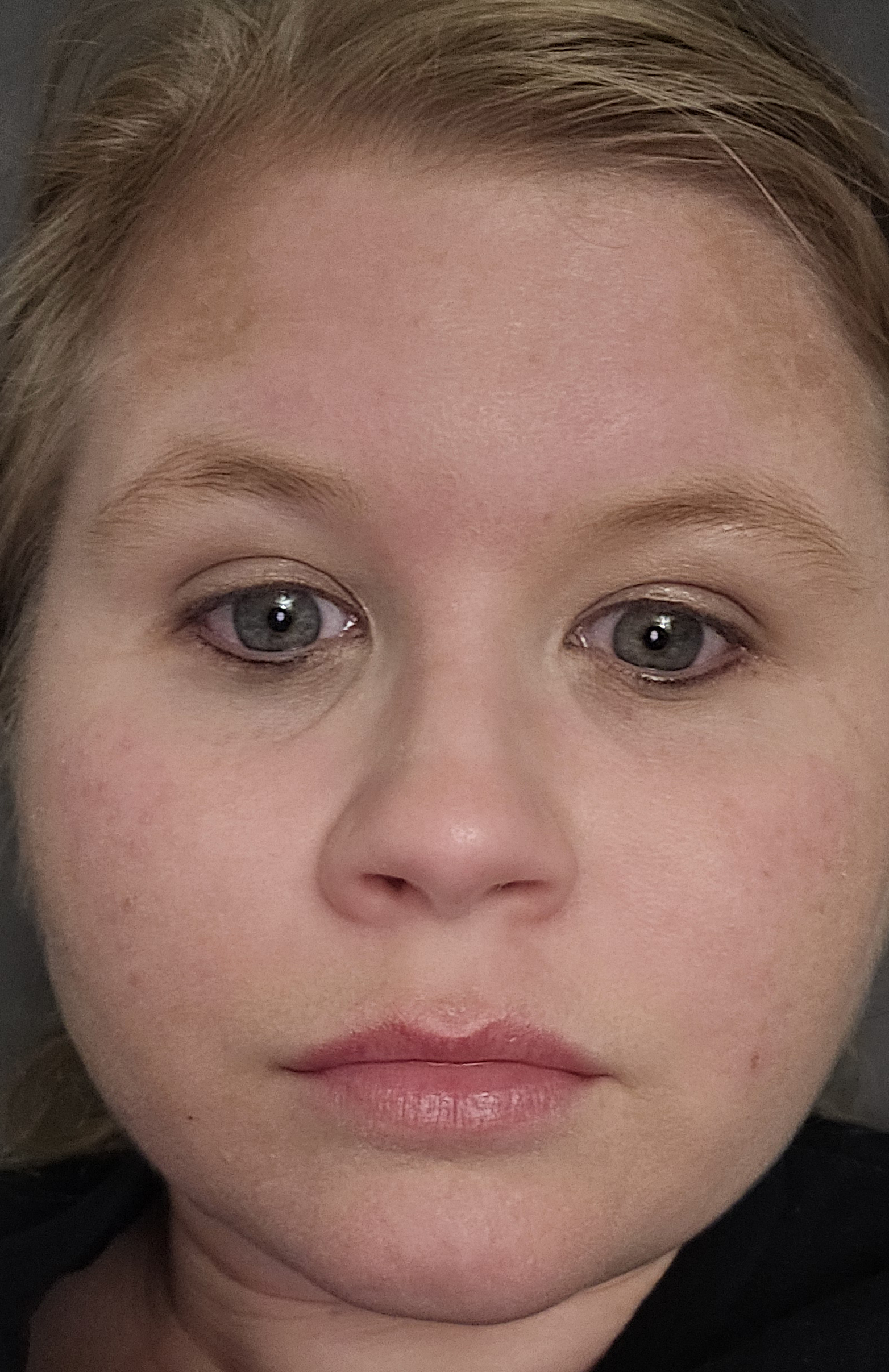 Nichole E., 35 After