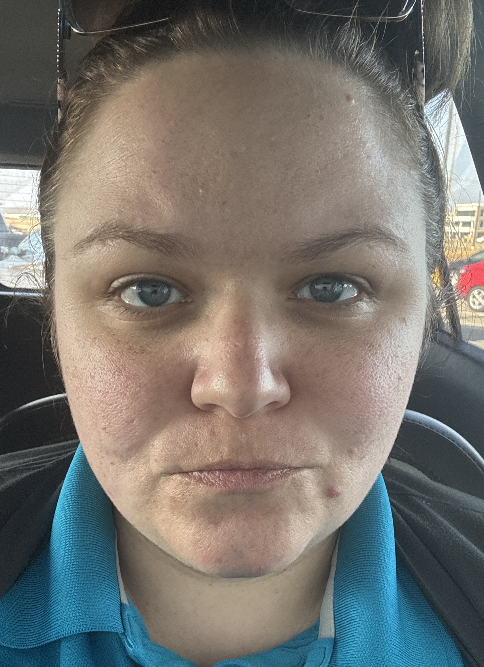 Tasha C., 35 After