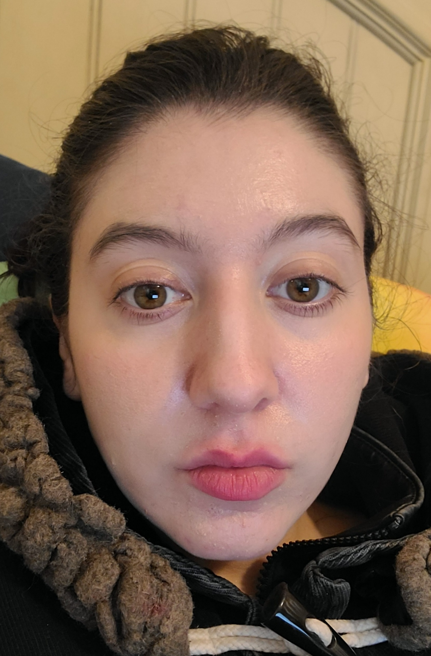 Brianna A., 25 After