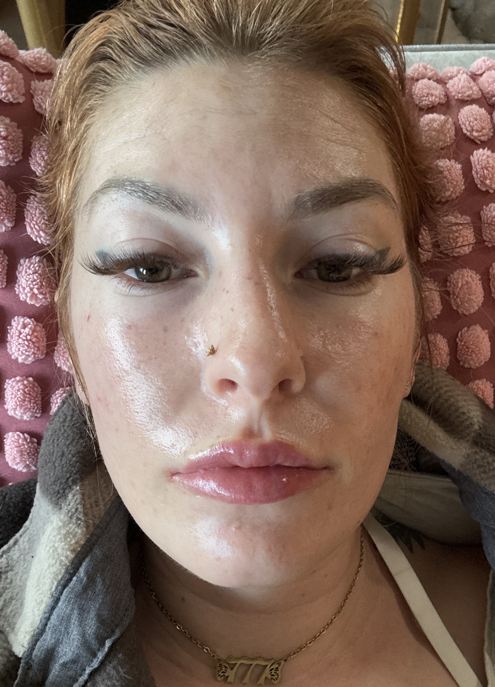Vanessa S., 34 After
