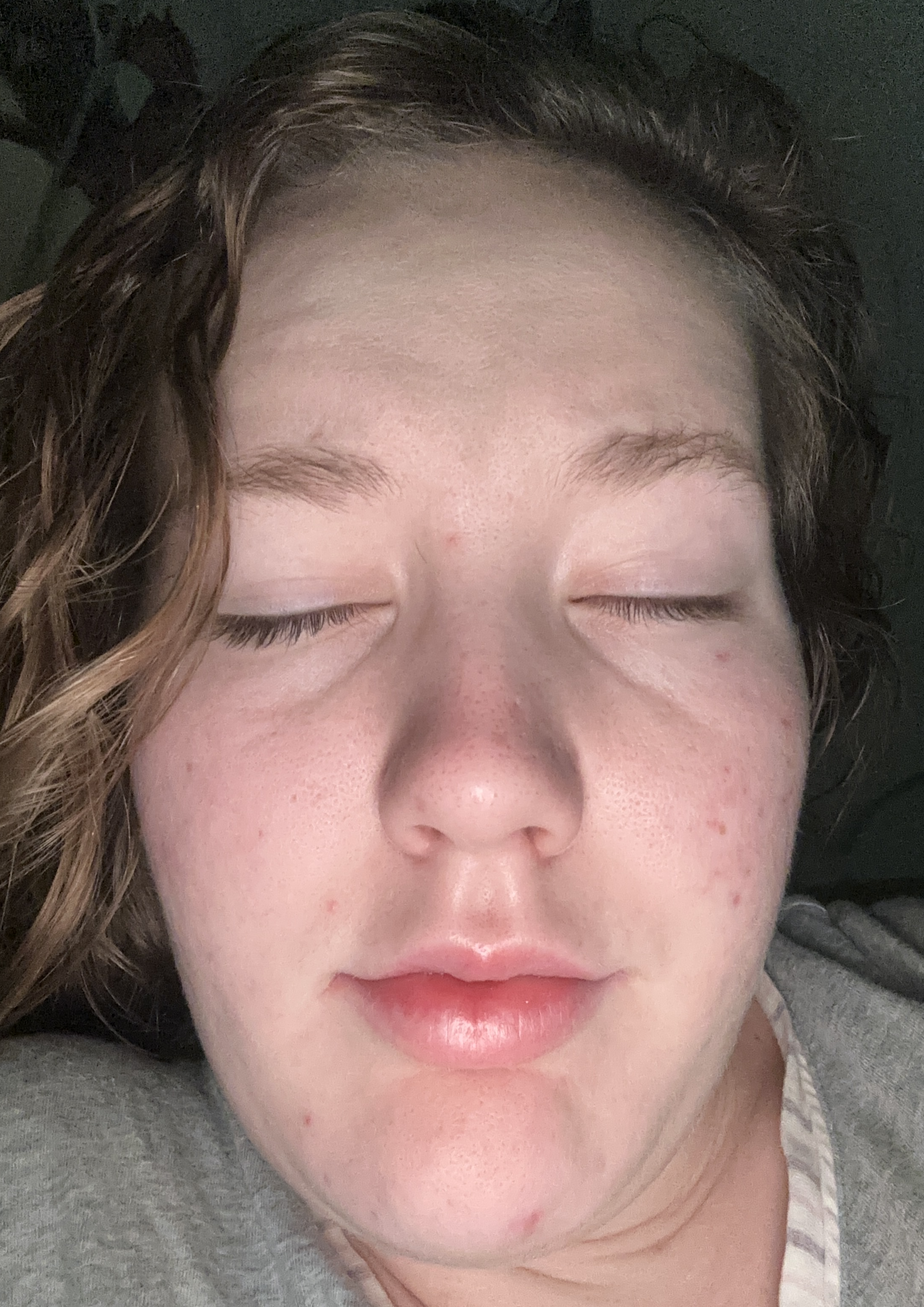 Ellianna R., 20 After