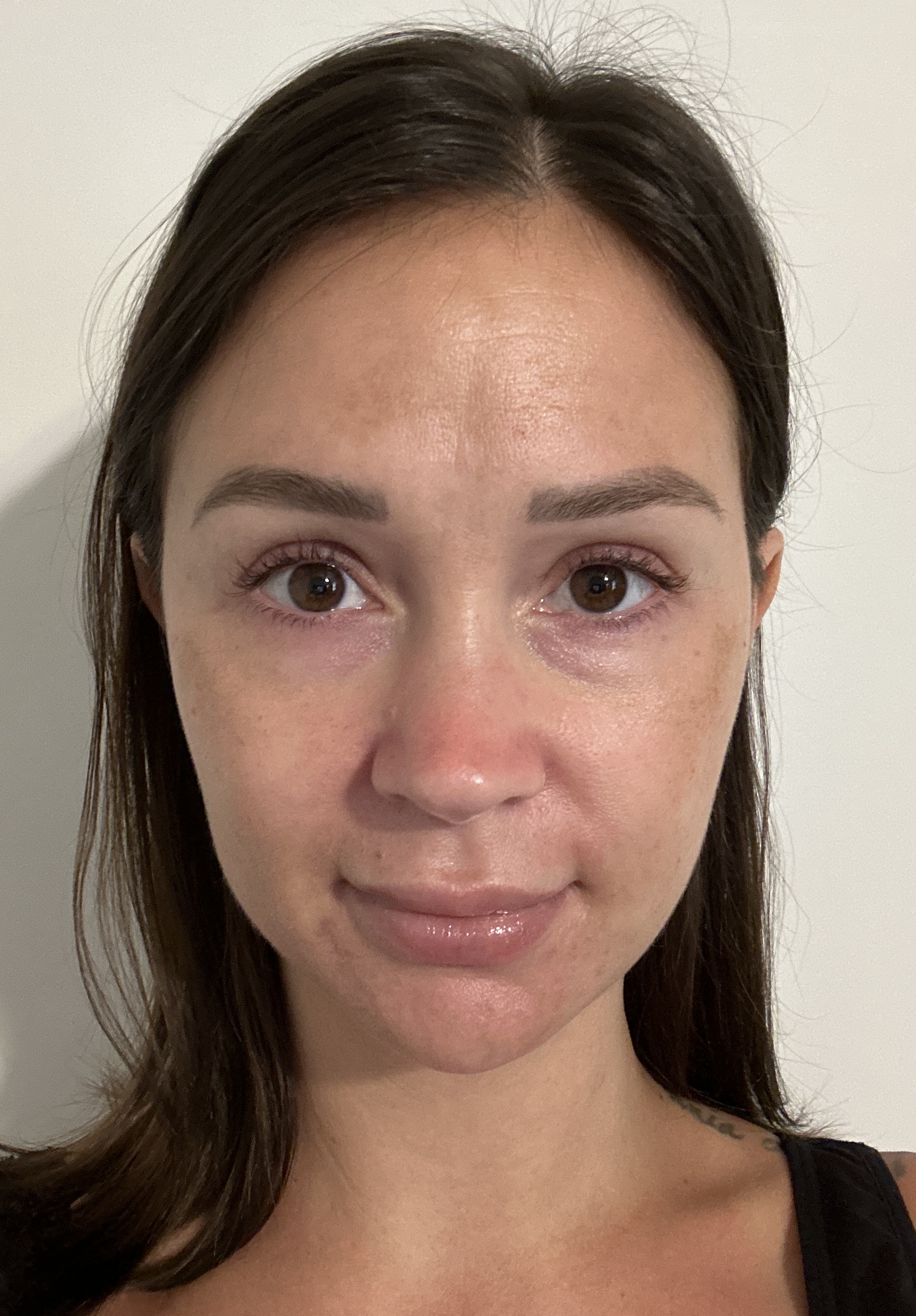Stephanie S., 34 After