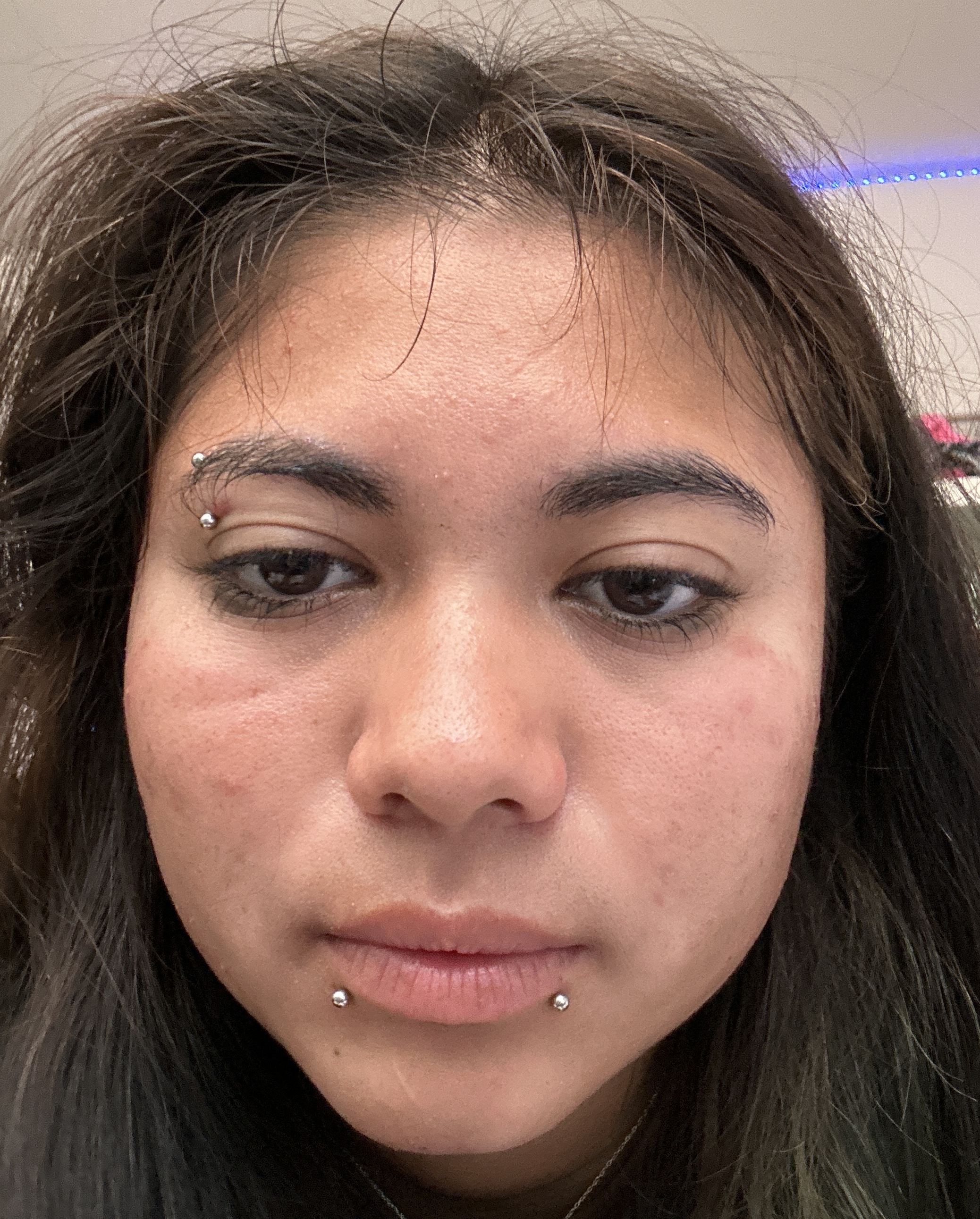 Jade H., 19 After
