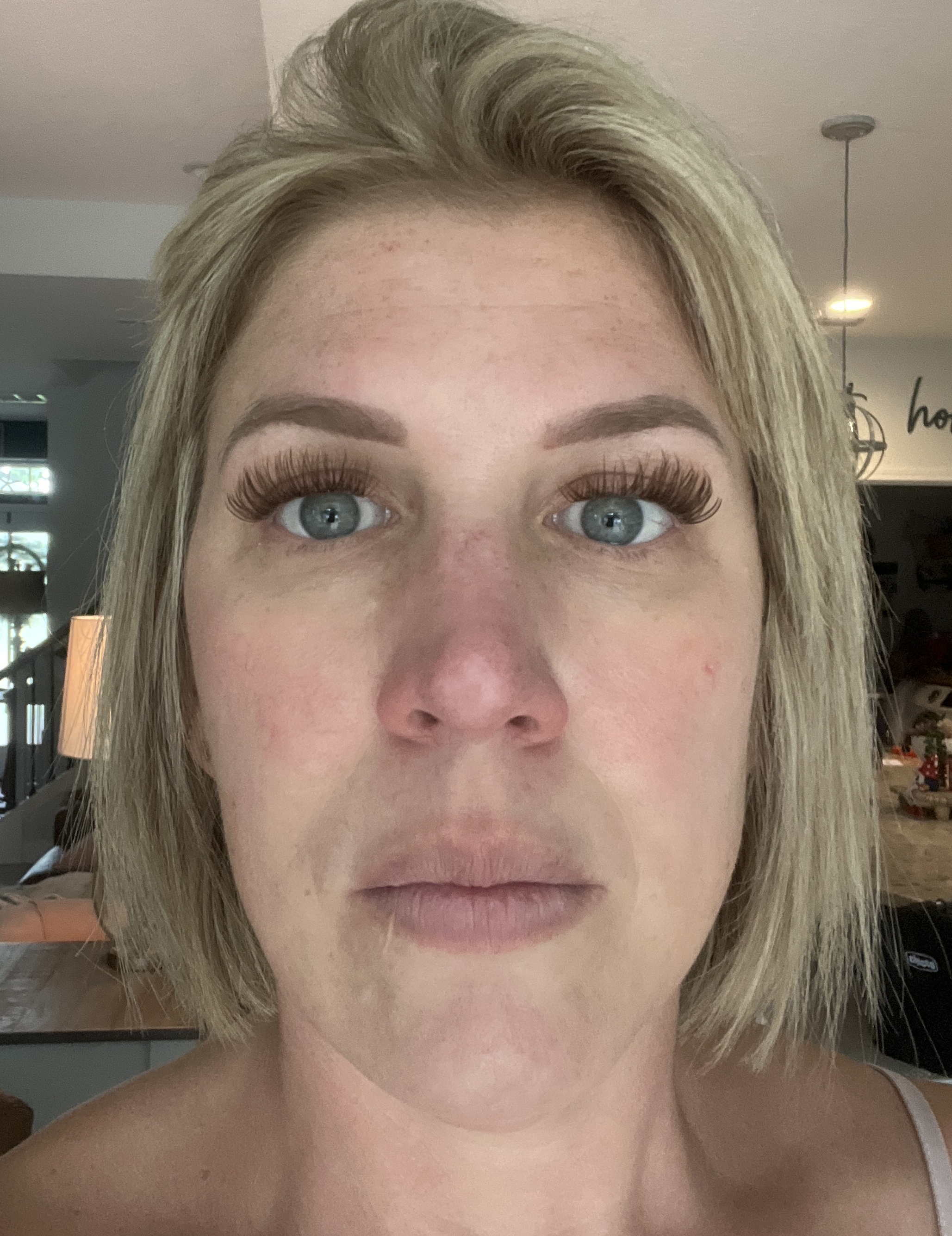 Lauren W., 42 After