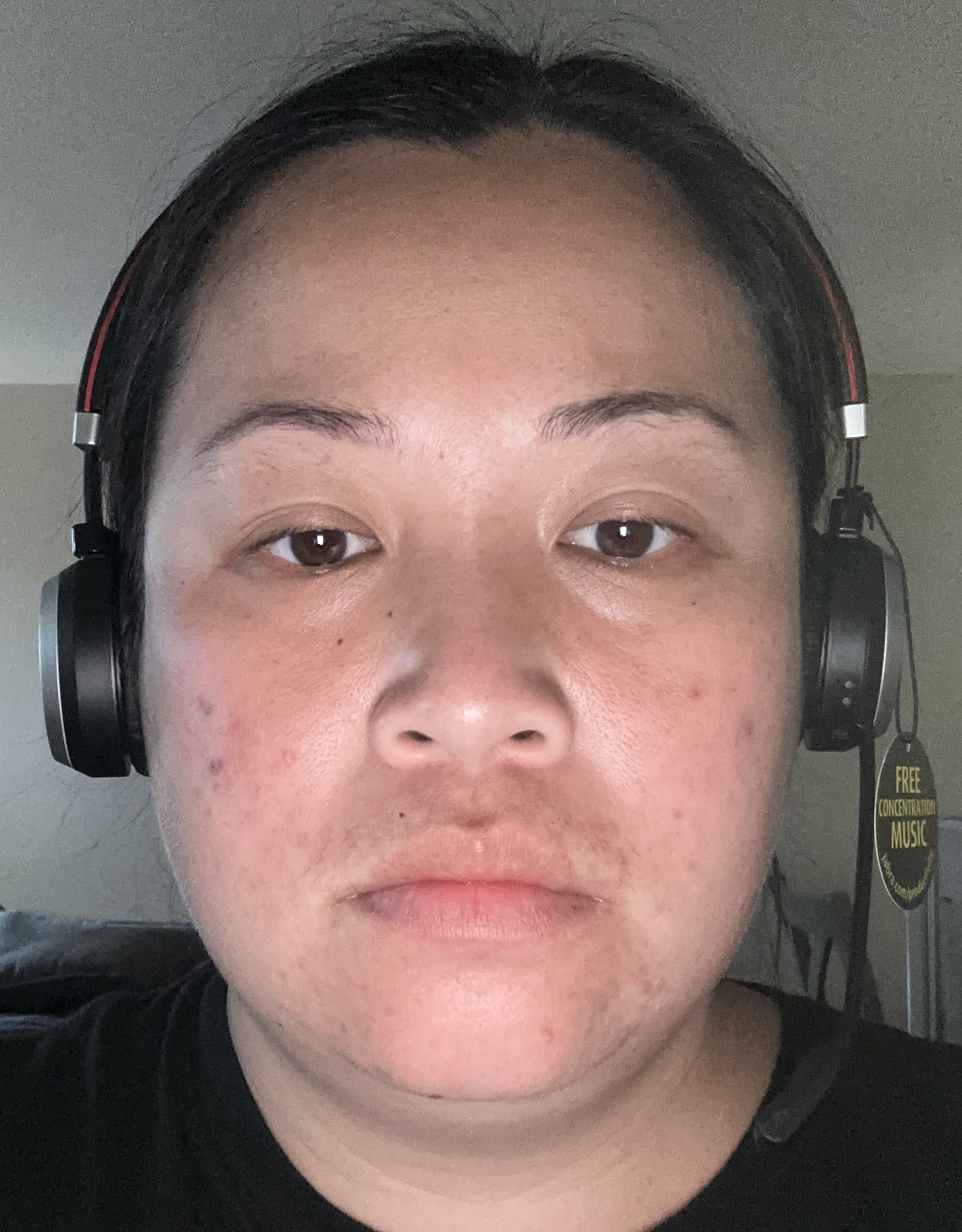 Lwinlwintun R., 33 After